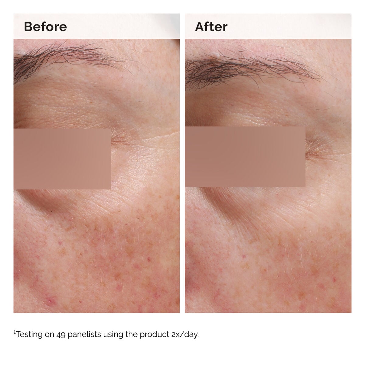 niacinamide-5-face-and-body-emulsion-h7 2024-08-23-ORD-Nia-5pct-Face-Body-B-A-Elasticity-Global-02-1x1.jpg