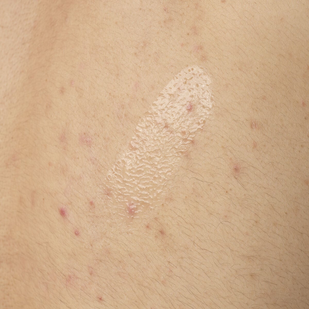 salicylic-acid-0-5-body-serum-y4 ORD-salicylic-acid-05-body-240ml-application.jpg