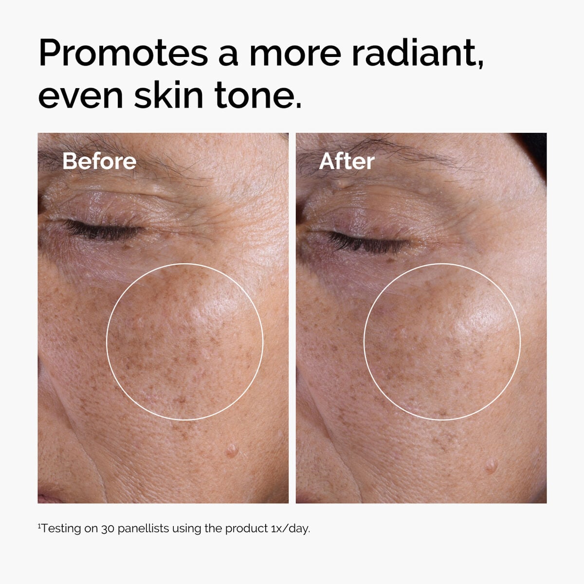 glycolic-acid-7-exfoliating-toner-h4 ord-glycolic-before-after-radiance.jpg