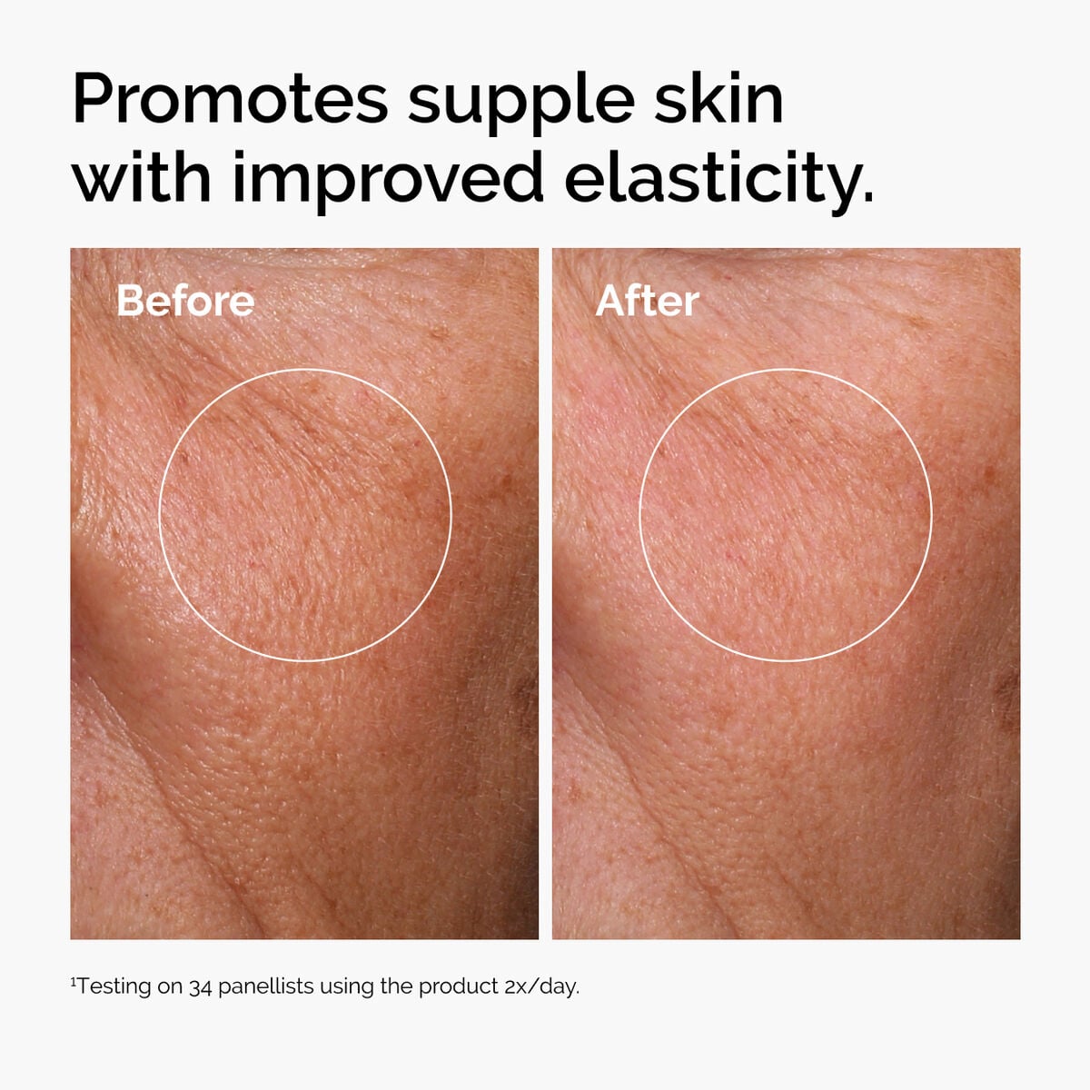hyaluronic-acid-2-b5-with-ceramides-h7 ord-hyaluronic-acid-2pct-b5-hydrating-serum-before-after-elasticity.jpg
