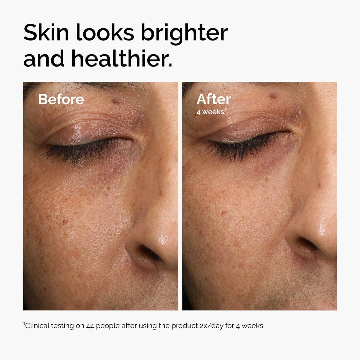 multi-antioxidant-radiance-serum-o5 ord-mars-before-after-healthy.jpg