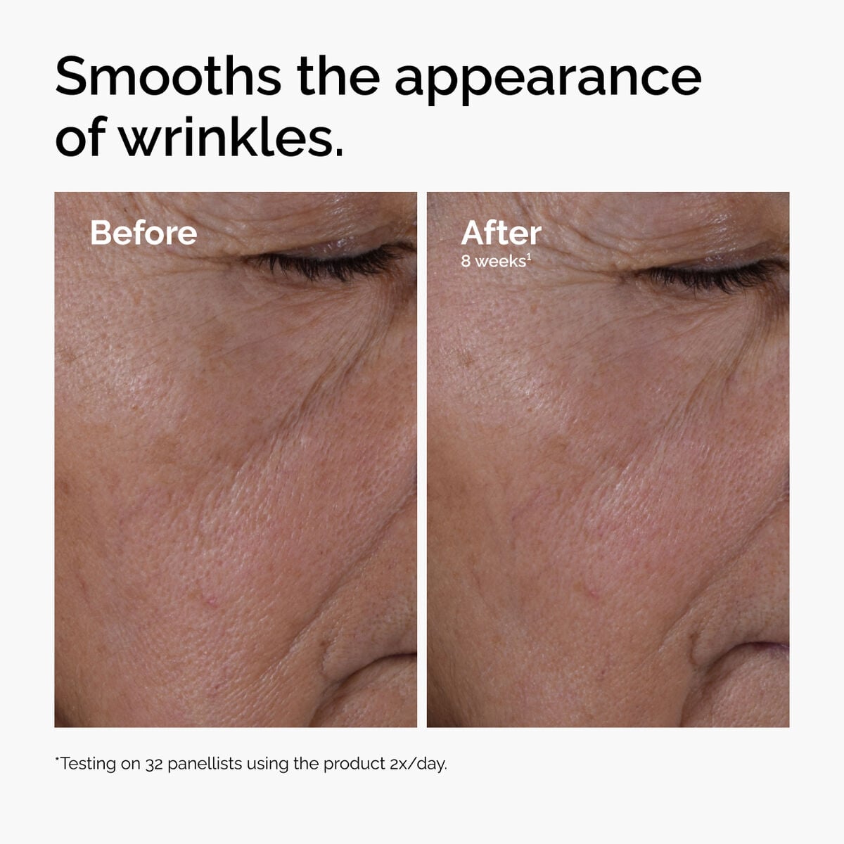multi-peptide-ha-serum-v1 ord-multi-peptide-ha-serum-wrinkles-before-after.jpg