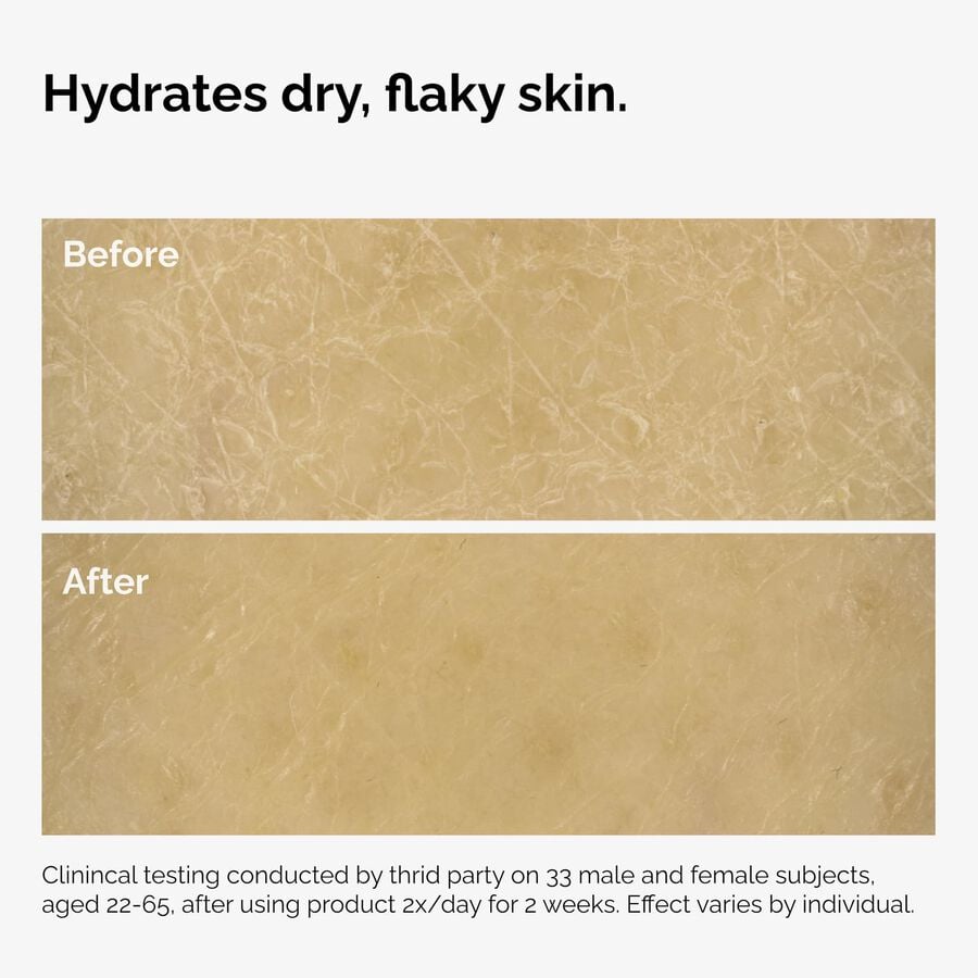 the-body-care-collection-u1 ord-natural-moisturizing-factors-inulin-body-before-after-graphic-02.jpg