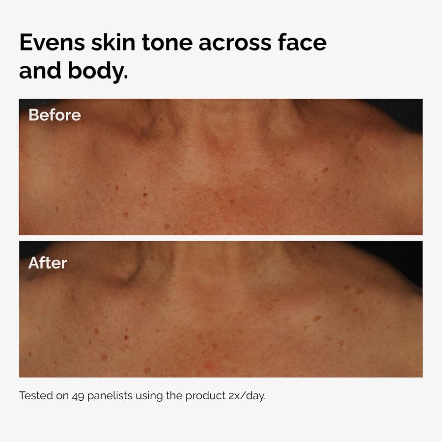 the-body-care-collection-u1 ord-niacinamide-face-body-serum-before-after-even-tone-graphic.jpg