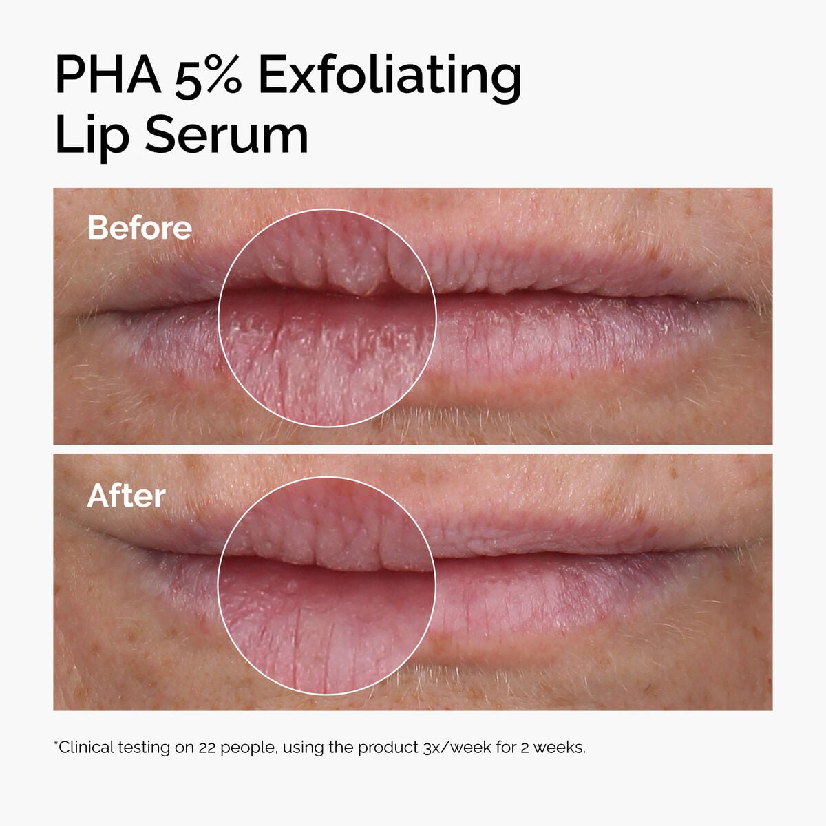 pha-5-exfoliating-lip-serum-a9 ord-pha-5pct-lip-exfoliating-serum-before-after.jpg